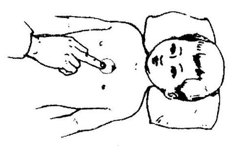小儿呃逆推拿