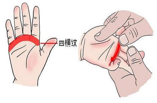 四横纹