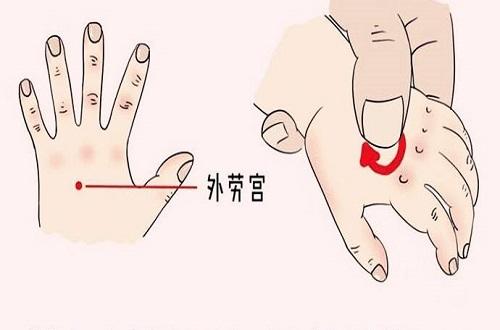 外劳宫