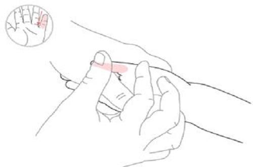 小儿推拿中耳炎按摩图