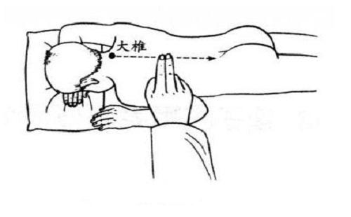 小儿大椎