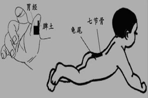 小儿便秘推拿