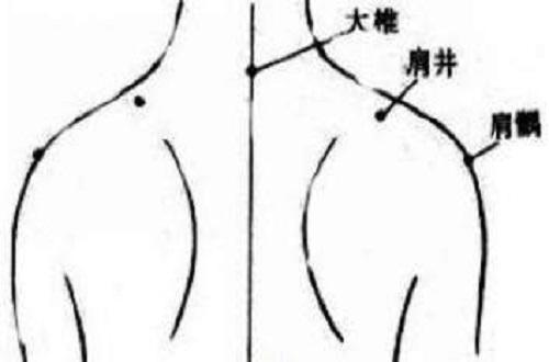 小儿肩井