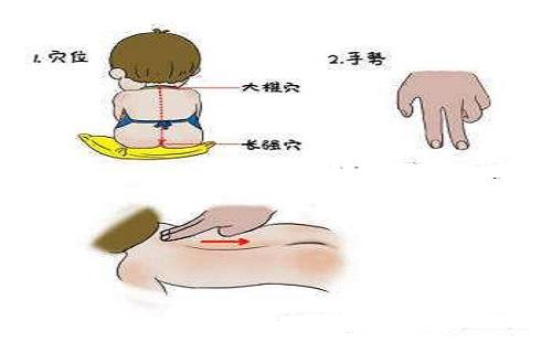 小儿大椎
