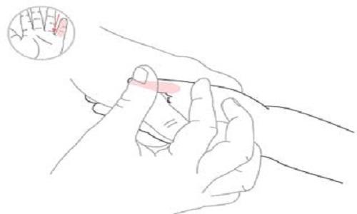 小儿手足口推拿手法