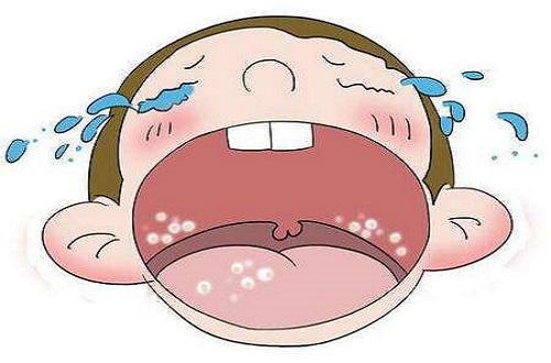鹅口疮推拿手法