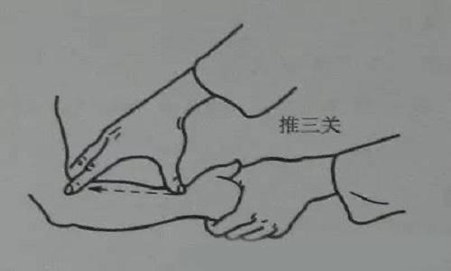 小儿麻疹推拿