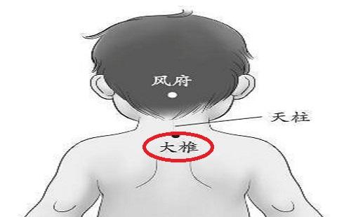 小儿大椎