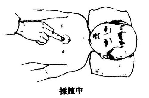 小儿推拿咳嗽手法