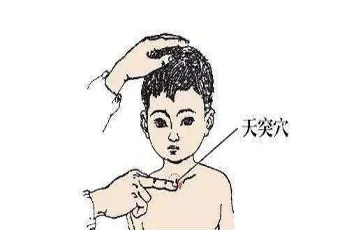 小儿天突