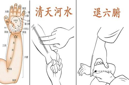 小儿急惊风推拿