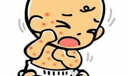 湿疹小儿推拿怎么治疗