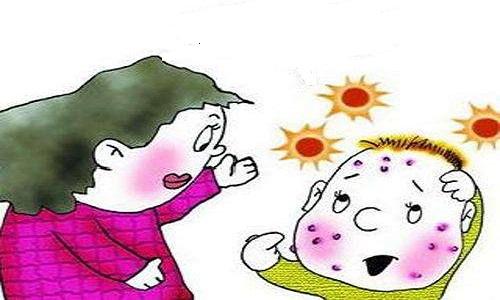 小儿按摩治疗水痘