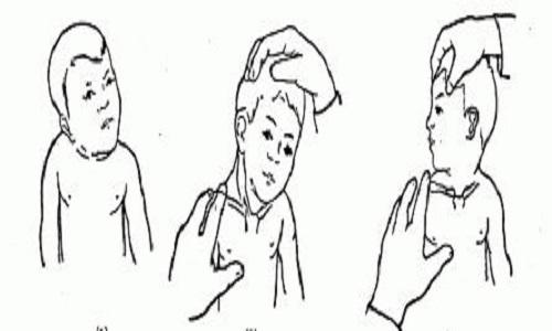 小儿肌性斜颈按摩手法