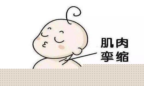 小儿肌性斜颈按摩手法