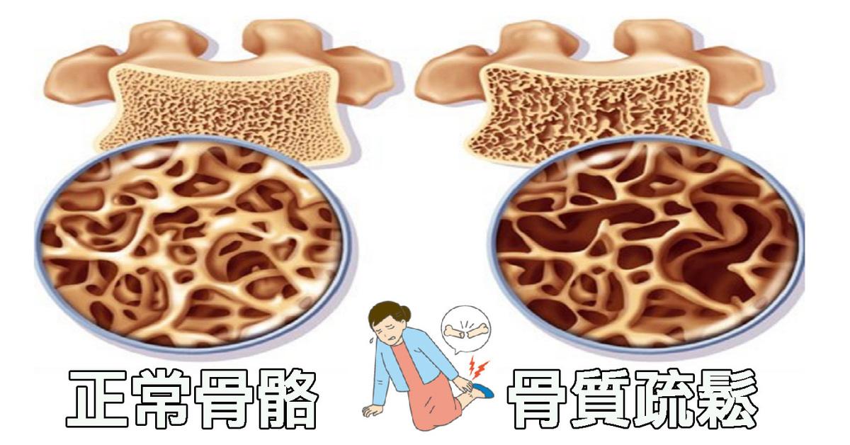 吃饱了撑的也是种病?吃太多小心这几种疾病