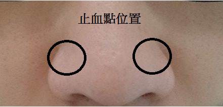 秋季流鼻血更加频繁，怎样才能有效止血呢?